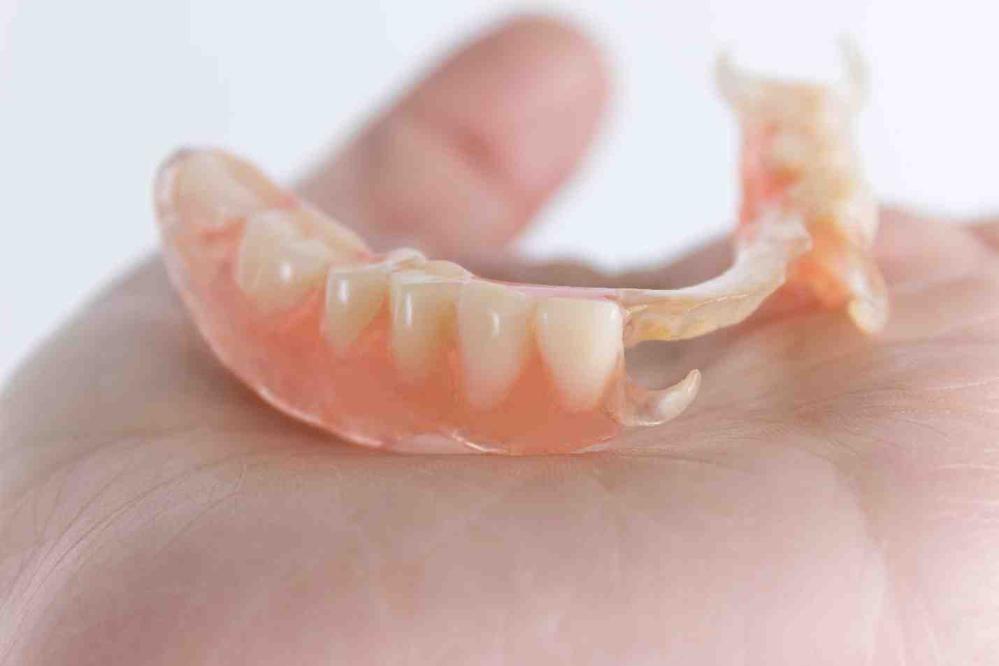 What are the disadvantages of dental bridges?