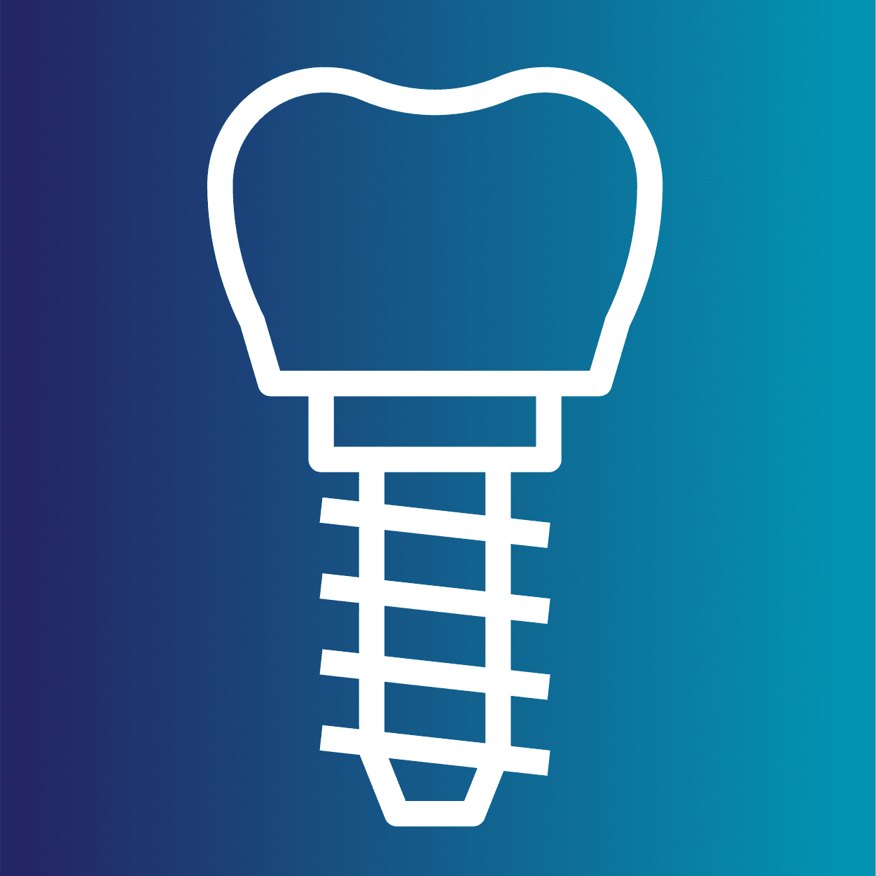 What are the disadvantages of veneers?
