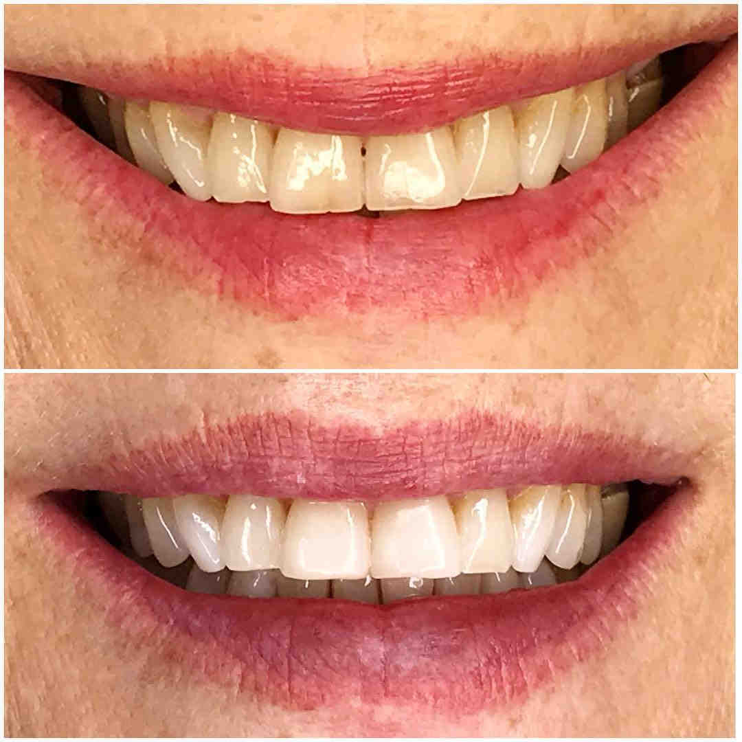 What are the most popular cosmetic dentistry procedures?