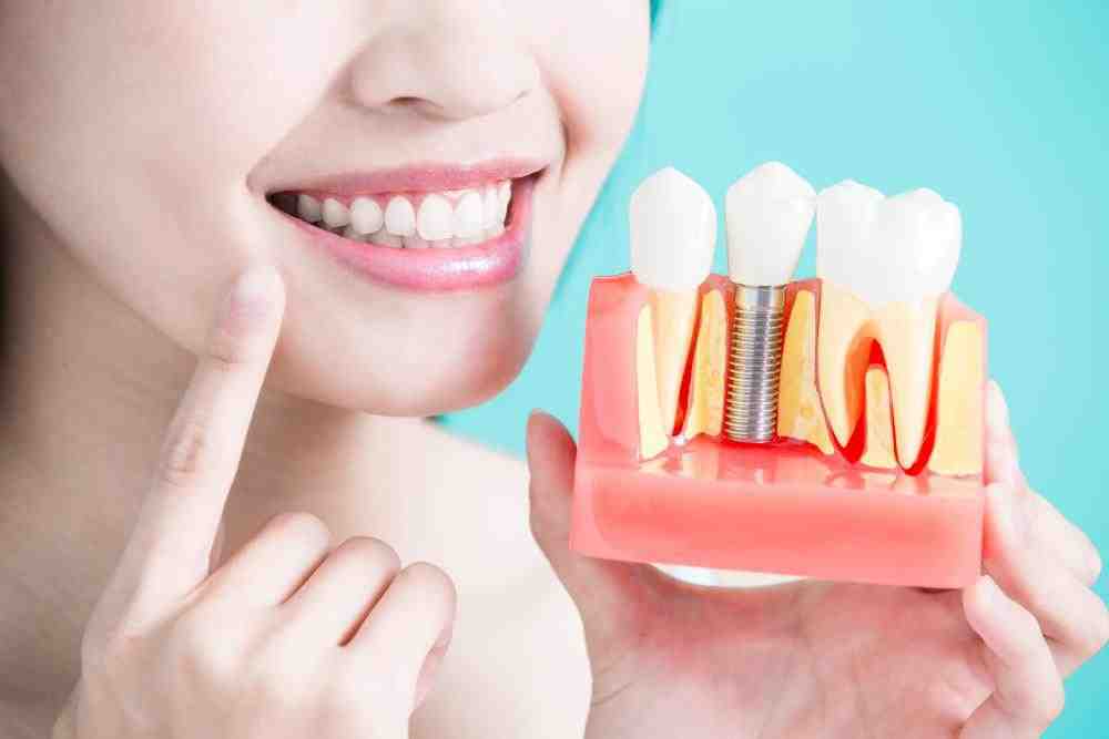 What are the problems with dental implants?