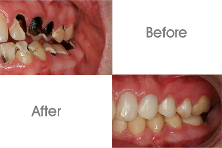 What does DeltaCare USA cover?