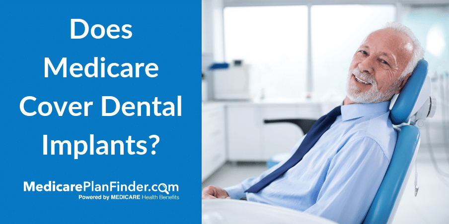 What does Denti Cal cover for adults 2021?