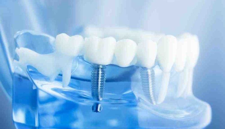 What happen when work in dental implant