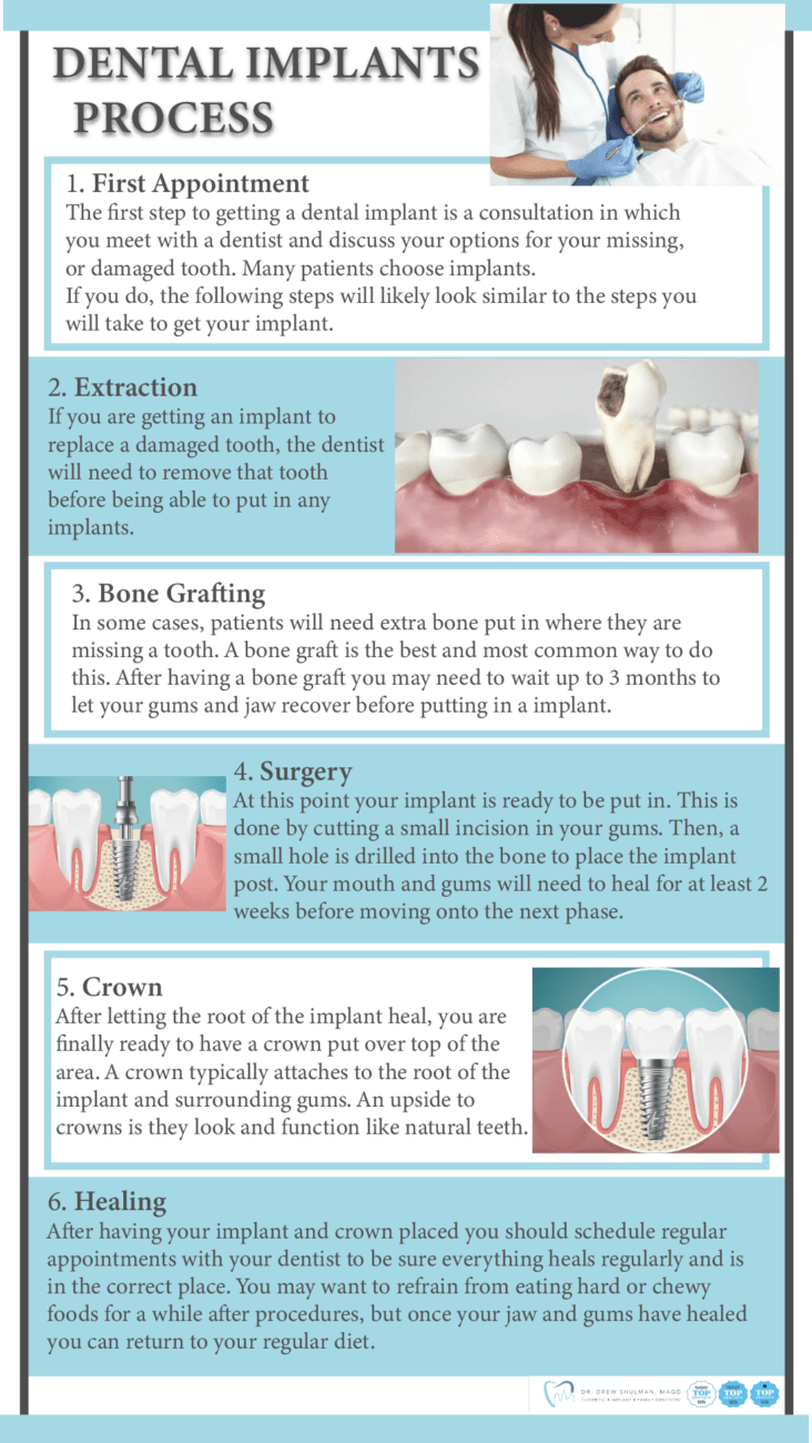 What happens if my dental implant moves?