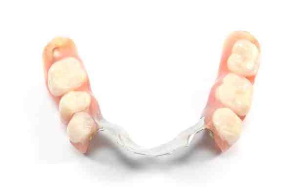 What is the average age for dentures?