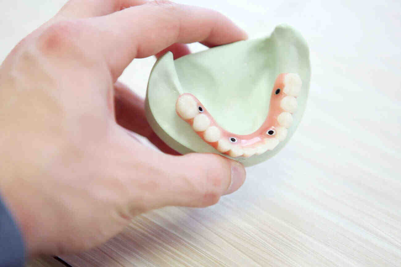 What is the best age for dental implants?