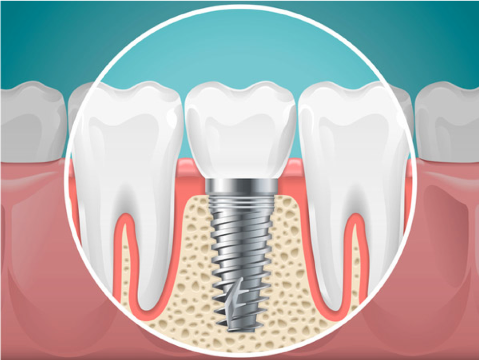 What is the difference between a dentist and a prosthodontist?