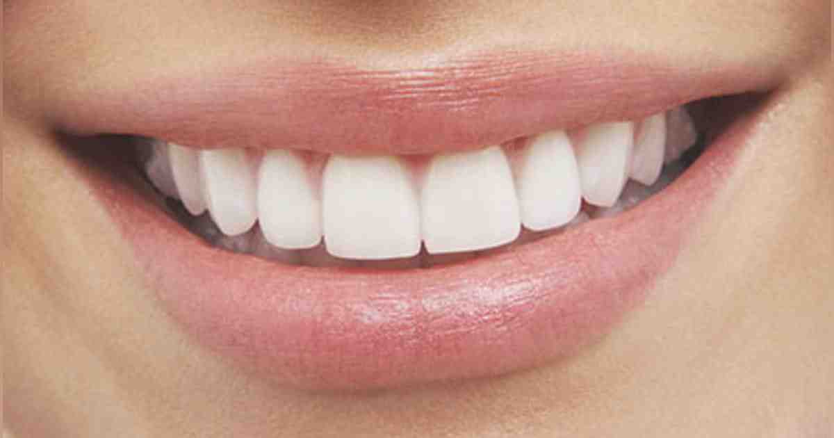 What is the most attractive smile?