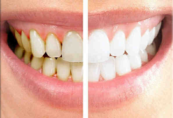 What is the movie the dentist about?