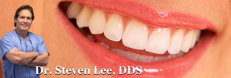What is the /ost of dental implants in fort wayne