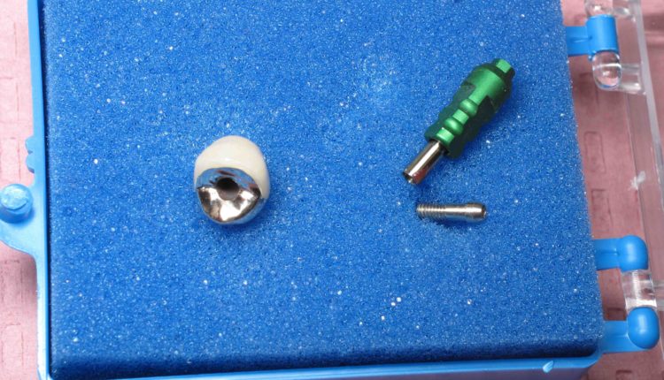 What kind of screws in dental implants