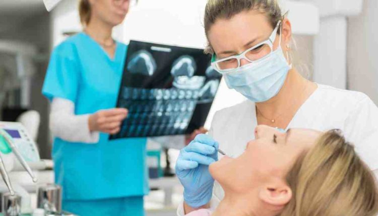 What products remove stains the best on dental implants