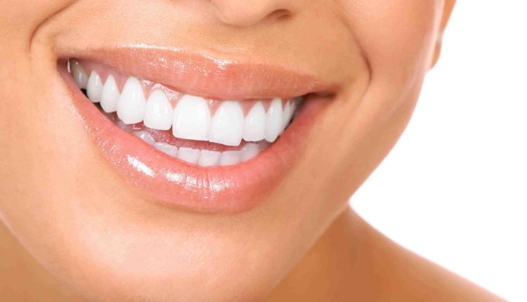 What sedation is used for dental implants