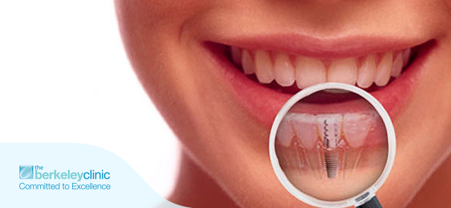 What should I avoid after dental implants?