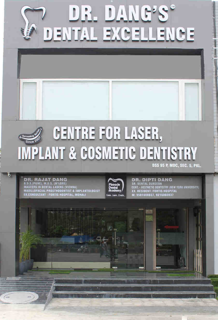 What's better Lumineers or veneers?