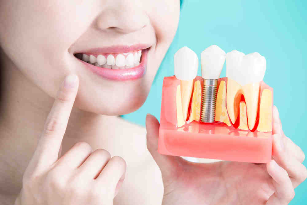 What's the pros and cons of dental implants?