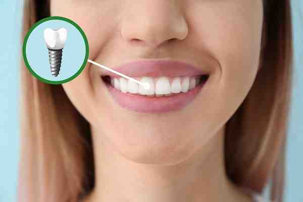 When does dental implant pain peak?