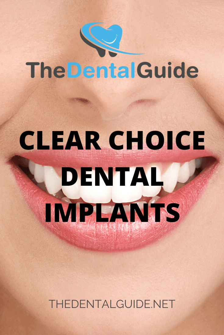 Which is better All-on-4 or all on 6 dental implants?