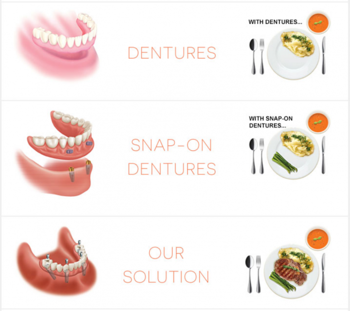 Who is not a good candidate for dental implants?