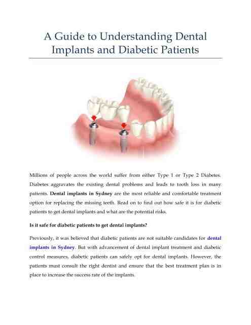 Who is not suitable for dental implants?