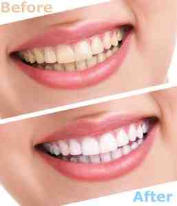 Why are my teeth still yellow even though I brush twice a day?