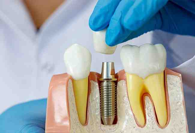 Why do bisphosphonates cause osteonecrosis of the jaw?