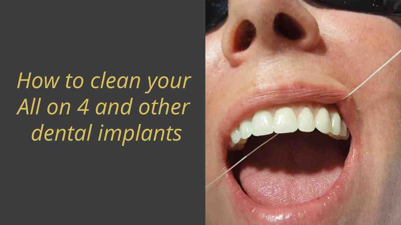 Why is my dental implant turning black?