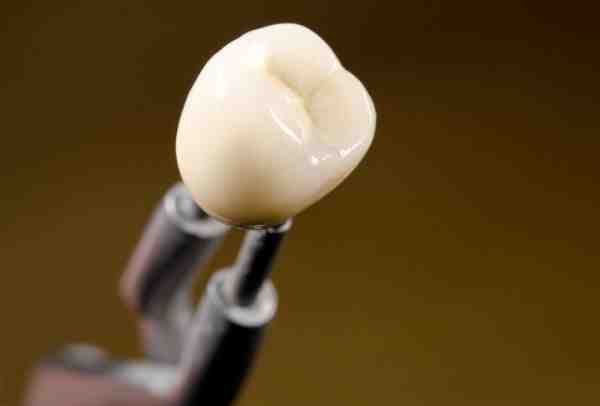 Why is my gum black around my implant?