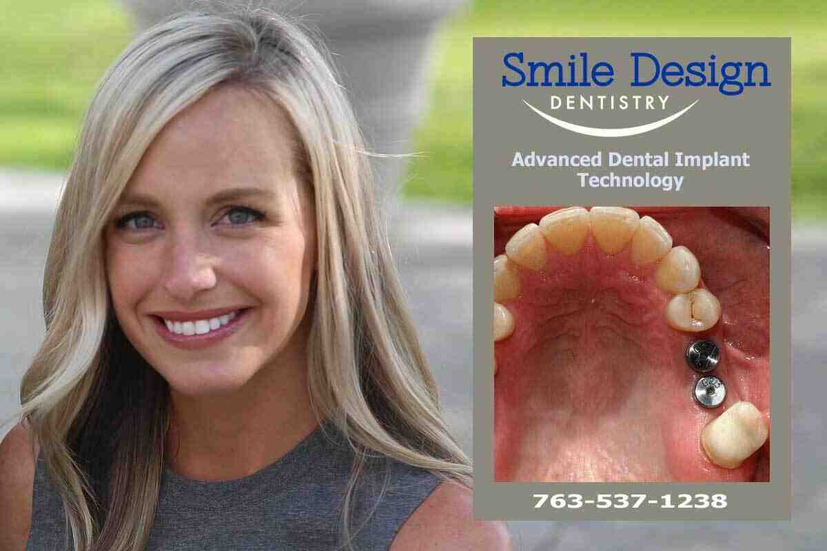 Why would a dental implant become loose?