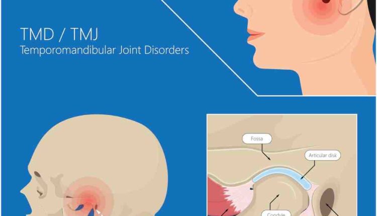 Will insurance cover dental implants if you have tmj