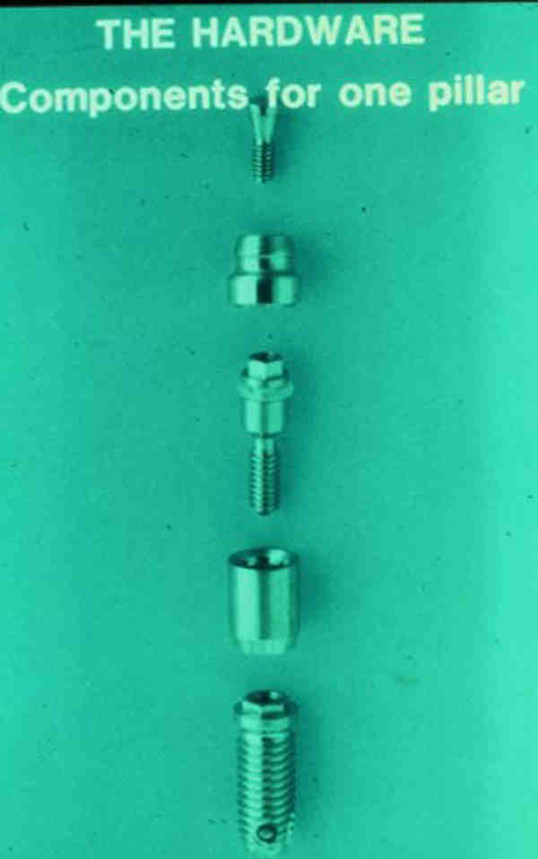 What is a custom dental implant abutment Dental News Network