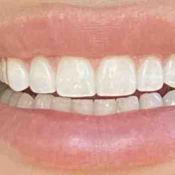 Do dentists live comfortably?