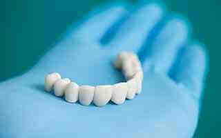 Do the Kardashians have veneers?