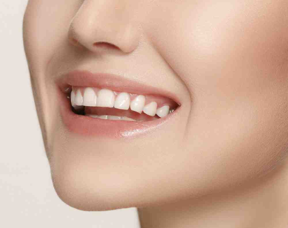 Does Medicaid cover braces?