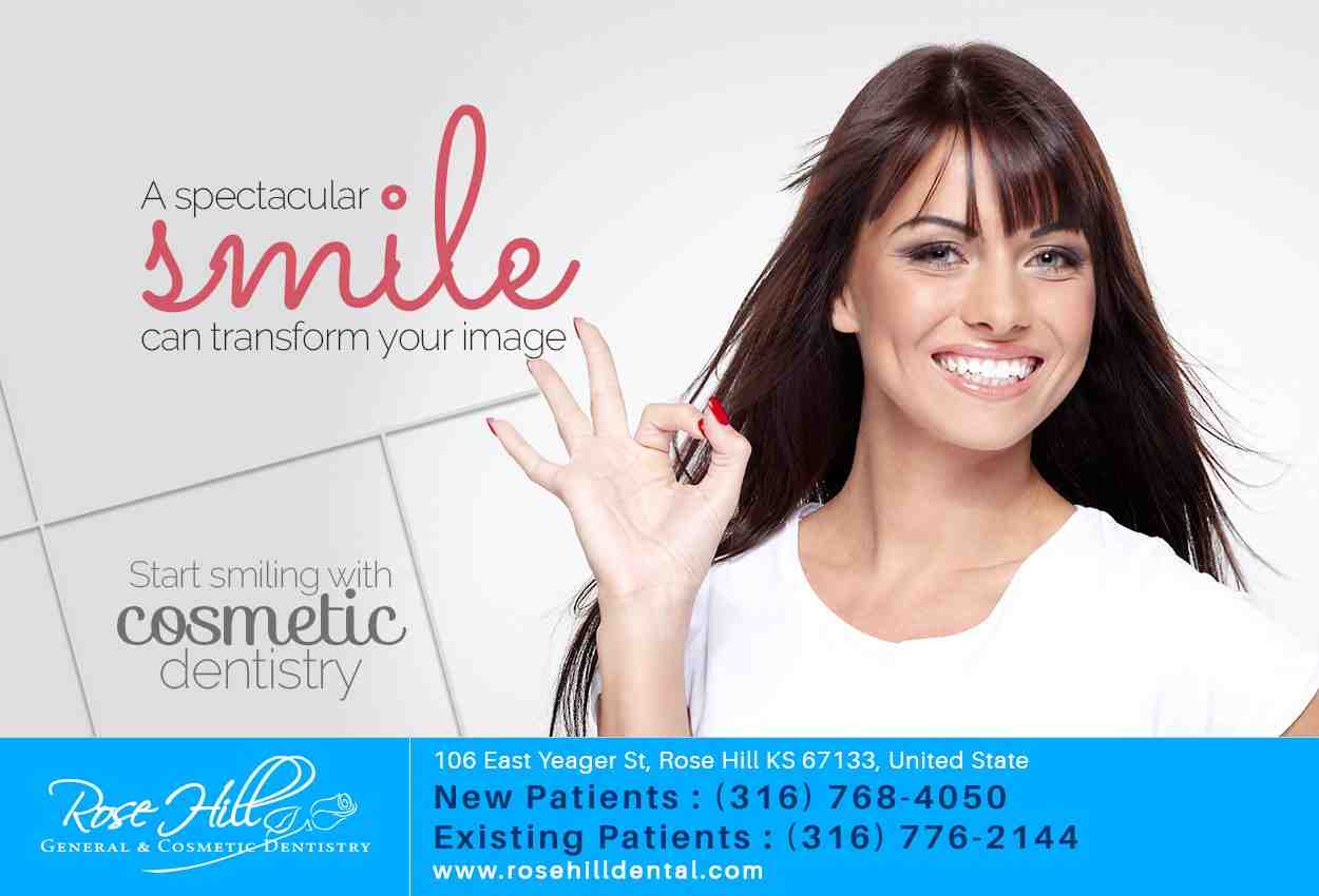 How do you fit a snap on smile at home?