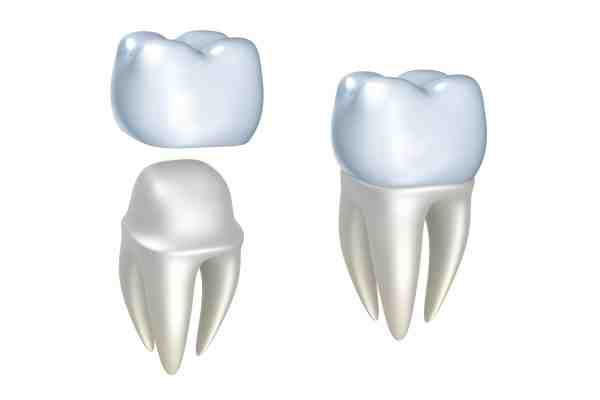 How do you know if your body is rejecting a dental implant?