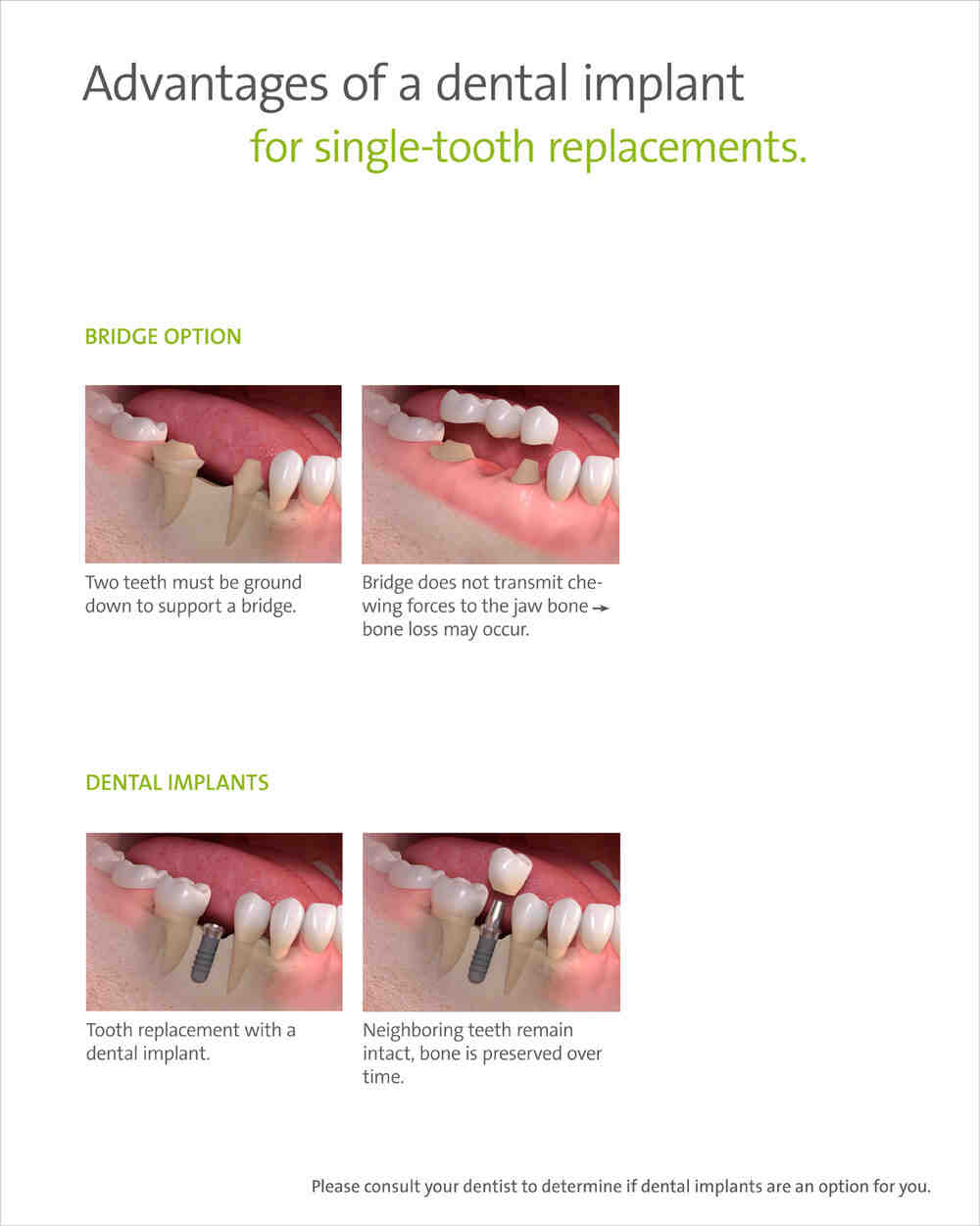 How long does it take for gums to heal after dental implants?