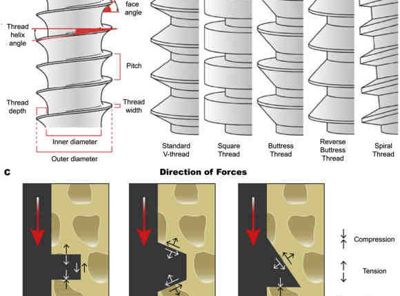 How long for dental implant osseointegration