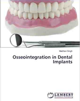 How long for dental implant osseointegration