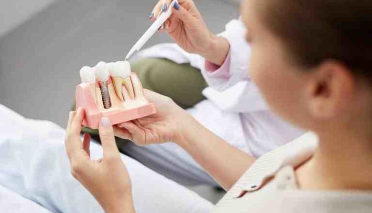 How many dental implants are placed each year in the us