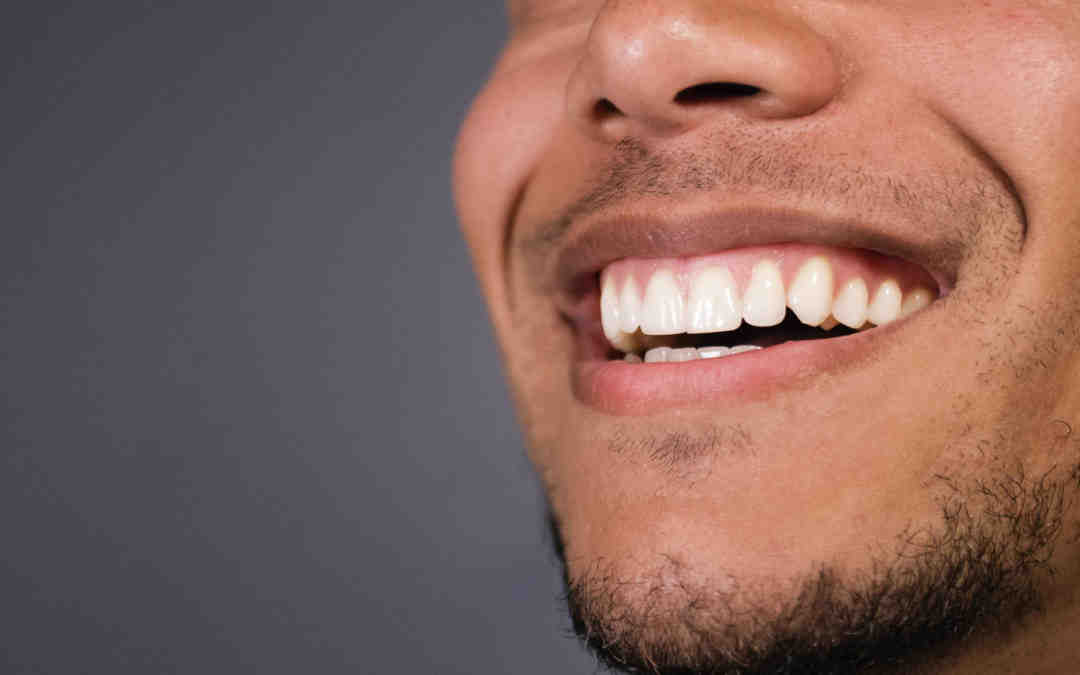 How many implants does it take for a full set of teeth?