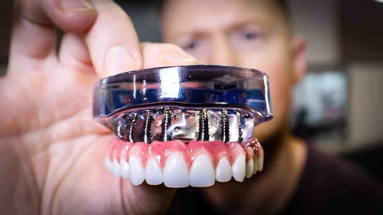 How painful is a tooth implant?