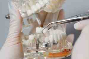 How painful is getting a tooth implant?