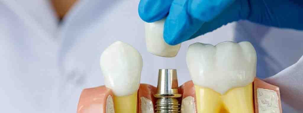 Is bone grafting toxic?