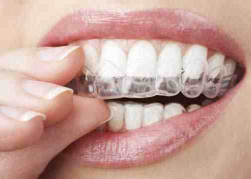 Is going to the dentist once a year OK?