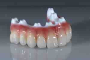 Is having dental implants painful?
