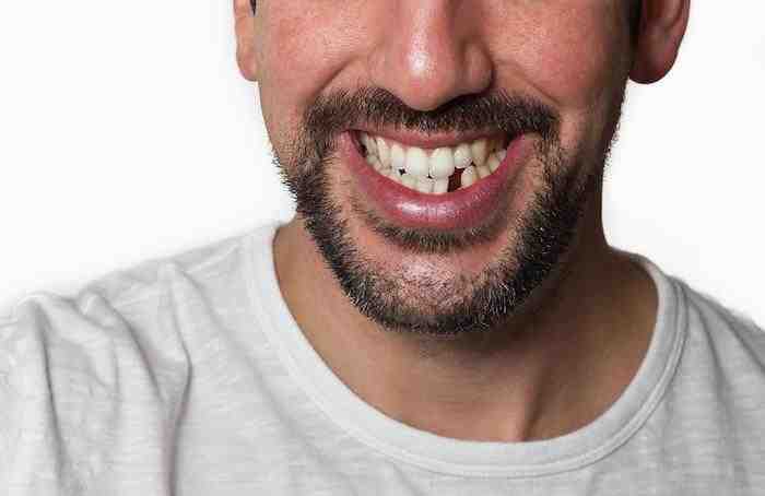 Is it normal to have pain 10 days after dental implant?
