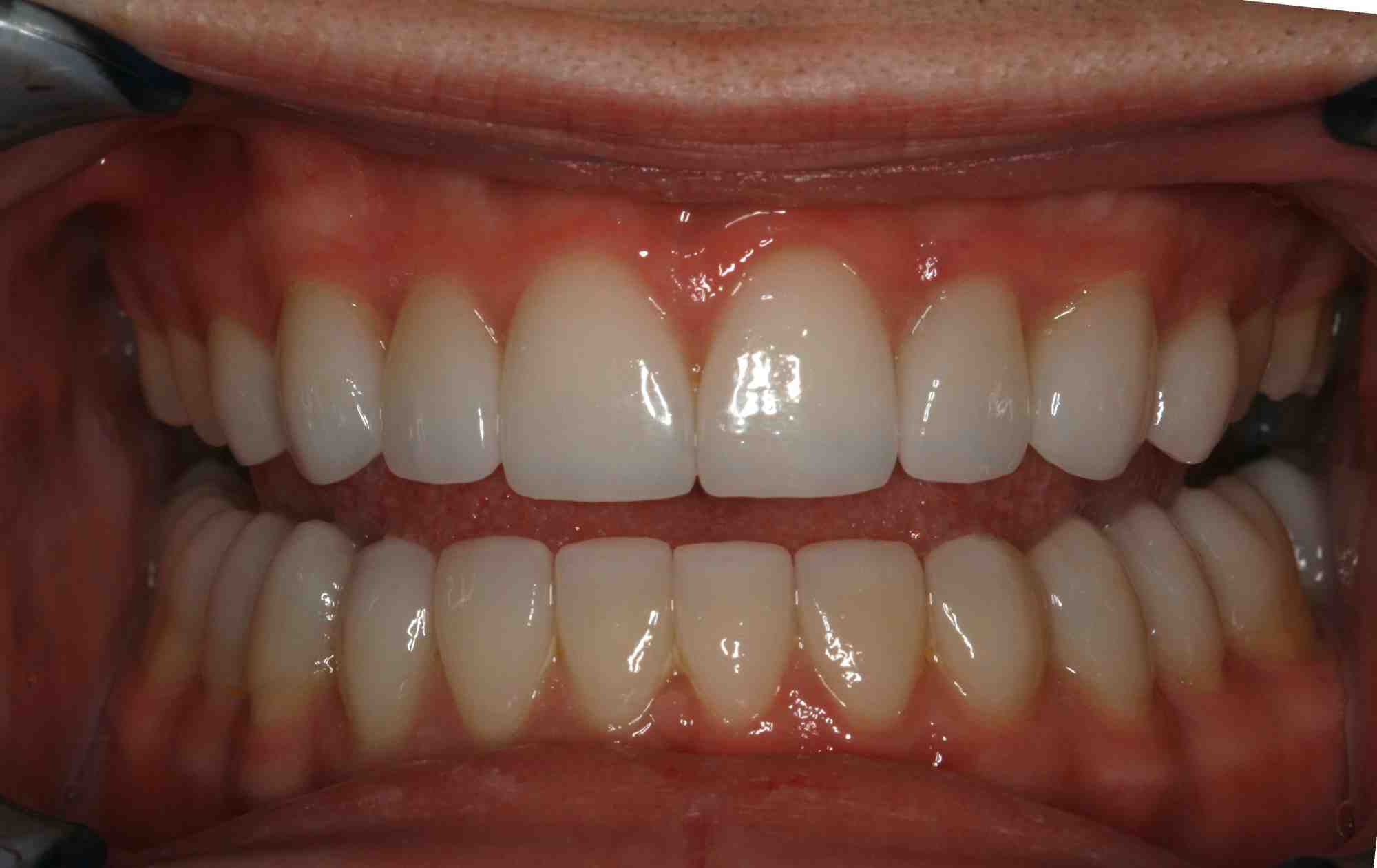Is jaw surgery medically necessary?