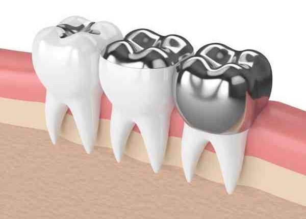 Pros of cosmetic dentistry