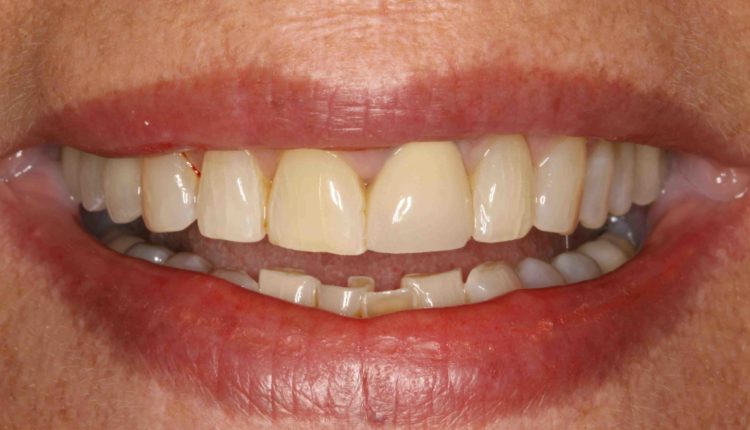 Ritter+&+ramsey+general+and+cosmetic+dentistry,+500+university+blvd+109,+jupiter,+fl+33458